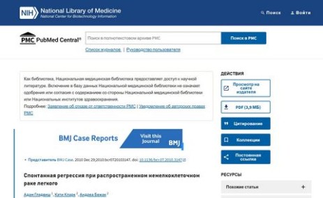 Статья о спонтанном регрессе карциномы в национальной медицинской библиотеке США